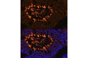 Immunofluorescence analysis of Rat testis using  antibody (ABIN7265353) at dilution of 1:100. (AKAP4 Antikörper  (AA 189-340))