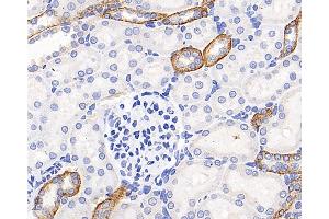 Immunohistochemistry analysis of paraffin-embedded rat kidney using CXCR7 Polyclonal Antibody at dilution of 1:200.