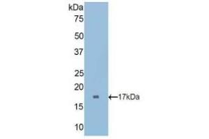 Detection of Recombinant CUBN, Rat using Polyclonal Antibody to Cubilin (CUBN) (CUBN Antikörper  (AA 3157-3274))