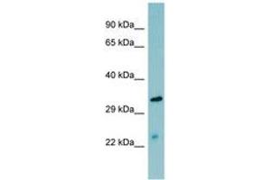 Image no. 1 for anti-Mannan-Binding Lectin serine Peptidase 2 (MASP2) (AA 35-84) antibody (ABIN6741648) (MASP2 Antikörper  (AA 35-84))