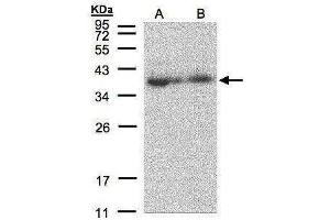 WB Image Sample(30 μg of whole cell lysate) A:293T B:A431, 12% SDS PAGE antibody diluted at 1:500 (MRPL3 Antikörper  (C-Term))