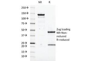 SDS-PAGE Analysis of Purified, BSA-Free Transglutaminase 2 Antibody (clone TGM2/419). (Transglutaminase 2 Antikörper)