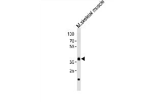 Western blot analysis of lysate from mouse skeletal muscle tissue, using Dbx1 Antibody (C-term) (ABIN6243427 and ABIN6577688). (DBX1 Antikörper  (C-Term))