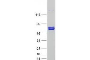 Western Blotting (WB) image for Jumonji Domain Containing 6 (JMJD6) (Transcript Variant 1) protein (Myc-DYKDDDDK Tag) (ABIN2723938)