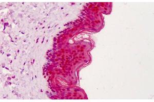 Human Skin: Formalin-Fixed, Paraffin-Embedded (FFPE) (APEX1 Antikörper)