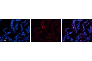 Rabbit Anti-CRIP2 Antibody     Formalin Fixed Paraffin Embedded Tissue: Human Lung Tissue  Observed Staining: Cytoplasmic in alveolar type I cells  Primary Antibody Concentration: 1:100  Other Working Concentrations: 1/600  Secondary Antibody: Donkey anti-Rabbit-Cy3  Secondary Antibody Concentration: 1:200  Magnification: 20X  Exposure Time: 0. (CRIP2 Antikörper  (Middle Region))