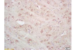 Formalin-fixed and paraffin embedded rat brain labeled with Rabbit Anti ARTS Polyclonal Antibody, Unconjugated (ABIN872659) at 1:200 followed by conjugation to the secondary antibody and DAB staining (Septin 4 Antikörper  (AA 91-150))