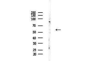 anti-Tigger Transposable Element Derived 4 (TIGD4) (Internal Region) antibody