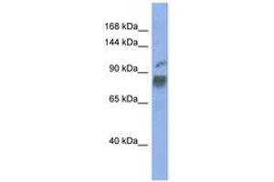 Image no. 1 for anti-Heterogeneous Nuclear Ribonucleoprotein U-Like 1 (HNRNPUL1) (AA 467-516) antibody (ABIN6743001) (HNRNPUL1 Antikörper  (AA 467-516))