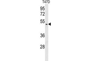 Western Blotting (WB) image for anti-BRISC and BRCA1 A Complex Member 1 (BABAM1) antibody (ABIN3003809) (BRISC and BRCA1 A Complex Member 1 (BABAM1) Antikörper)