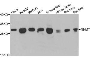 Western blot analysis of extracts of various cell lines, using NNMT antibody (ABIN5974021) at 1/1000 dilution. (NNMT Antikörper)