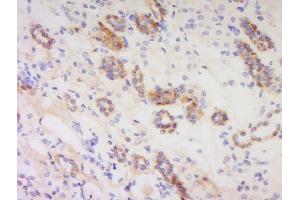 Immunohistochemistry (Paraffin-embedded Sections) (IHC (p)) image for anti-Pituitary Adenylate Cyclase Activating Polypeptide 38 (PACAP-38) (AA 31-38) antibody (ABIN726215)