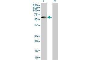 Western Blot analysis of HSFX1 expression in transfected 293T cell line by HSFX1 MaxPab polyclonal antibody. (HSFX1 Antikörper  (AA 1-423))