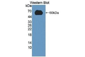Detection of Recombinant LDLR, Mouse using Polyclonal Antibody to Low Density Lipoprotein Receptor (LDLR) (LDLR Antikörper  (AA 263-509))