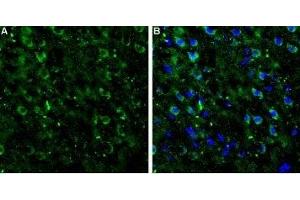 Expression of mGluR7 in rat neocortexImmunohistochemical staining of rat neocortex frozen sections using Anti-mGluR7 (extracellular) Antibody (ABIN7043255, ABIN7044346 and ABIN7044347). (Glutamate Receptor, Metabotropic 7 (GRM7) Peptid)