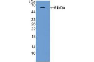 Western blot analysis of recombinant Human MR. (NR3C2 Antikörper  (AA 739-984))
