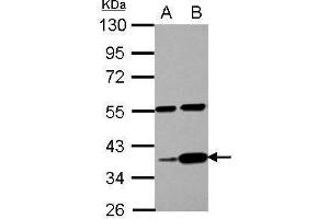 WB Image Sample (30 ug of whole cell lysate) A: PC-3 B: U87-MG 10% SDS PAGE antibody diluted at 1:1000 (LUZP4 Antikörper)