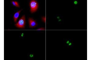 Fluorescence Microscopy (FM) image for anti-Histone 3 (H3) (pSer10) antibody (ABIN5706877)