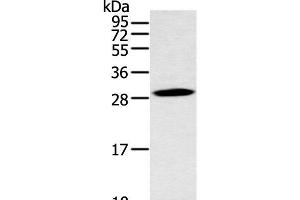 Western blot analysis of Mouse stomach tissue using YRDC Polyclonal Antibody at dilution of 1:400 (YRDC Antikörper)