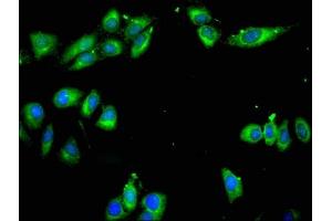 Immunofluorescent analysis of Hela cells using ABIN7143077 at dilution of 1:100 and Alexa Fluor 488-congugated AffiniPure Goat Anti-Rabbit IgG(H+L) (ARPC1A Antikörper  (AA 175-317))