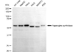 anti-Asparagine Synthetase (ASNS) antibody