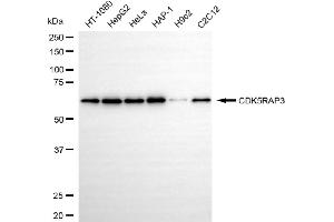 Western blotting analysis using CDK5RAP3 antibody (ABIN7797997). (Rekombinanter CDK5RAP3 Antikörper)