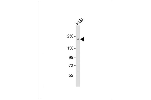 XRN1 Antikörper  (C-Term)