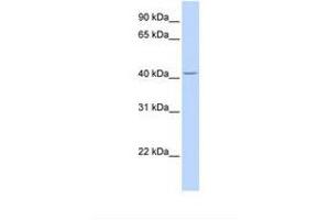 Image no. 1 for anti-Cytochrome P450, Family 4, Subfamily F, Polypeptide 12 (CYP4F12) (AA 432-481) antibody (ABIN6738619)