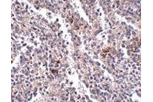 Immunohistochemistry of SYPL2 in human spleen tissue with this product at 2. (SYPL2 Antikörper  (C-Term))