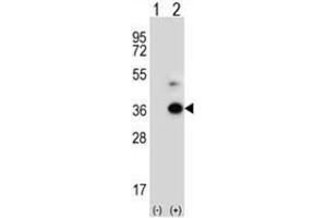 Western blot analysis of ANGPTL7 (arrow) using rabbit polyclonal ANGPTL7 Antibody (C-term) . (ANGPTL7 Antikörper  (C-Term))