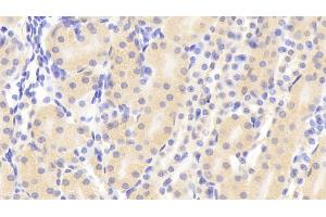 Immunohistochemistry (IHC) image for anti-Insulin-Like Growth Factor 1 (IGF1) (AA 49-153) antibody (ABIN7440332)