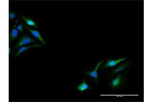 Immunofluorescence of purified MaxPab antibody to KPNA5 on HeLa cell.
