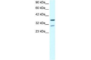 WB Suggested Anti-ZNF385 Antibody Titration:  0. (ZNF385A Antikörper  (N-Term))