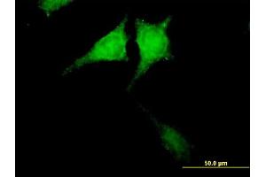 Immunofluorescence of purified MaxPab antibody to CARD8 on HeLa cell.