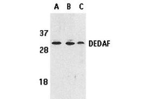 Western Blotting (WB) image for anti-RING1 and YY1 Binding Protein (RYBP) antibody (ABIN1031706) (RYBP Antikörper)