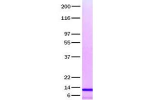 Validation with Western Blot (CCL14 Protein)