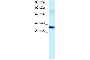 PARP1 antibody used at 5 ug/ml to detect target protein. (PARP1 Antikörper)