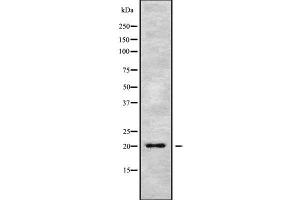 Western blot analysis of MED28 using MCF7 whole cell lysates