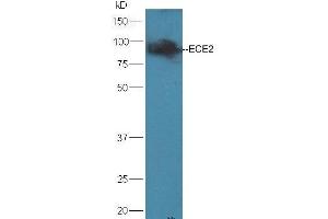 Mouse brain lysates probed with Rabbit Anti-ECE2 Polyclonal Antibody, Unconjugated (ABIN733958) at 1:300 overnight at 4 °C.