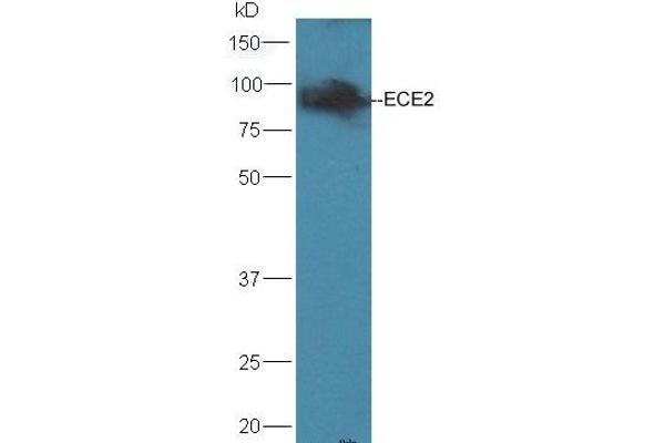 ECE2 Antikörper  (AA 601-700)