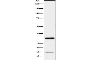 Western blot analysis of Geminin expression in HeLa cell lysate.