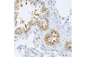 Immunohistochemistry (IHC) image for anti-Eukaryotic Translation Initiation Factor 2B, Subunit 2 Beta, 39kDa (EIF2B2) (AA 1-351) antibody (ABIN6140037)
