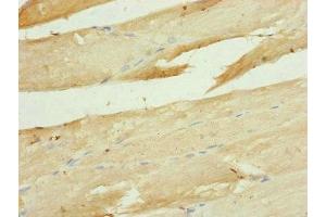 Immunohistochemistry of paraffin-embedded human skeletal muscle tissue using ABIN7149113 at dilution of 1:100 (UQCRC1 Antikörper  (AA 1-63))