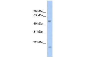 WB Suggested Anti-ZNF213 Antibody Titration:  0. (ZNF213 Antikörper  (Middle Region))