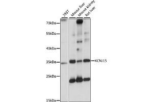 Western blot analysis of extracts of various cell lines, using KCNJ15 antibody (ABIN7269475) at 1:1000 dilution. (KCNJ15 Antikörper  (AA 221-375))