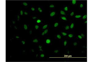 Immunofluorescence of monoclonal antibody to MEIS2 on HeLa cell. (MEIS2 Antikörper  (AA 1-381))