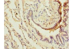 Immunohistochemistry of paraffin-embedded human lung tissue using ABIN7175622 at dilution of 1:100