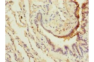 Immunohistochemistry of paraffin-embedded human lung tissue using ABIN7175622 at dilution of 1:100 (LRRC8E Antikörper  (AA 353-630))