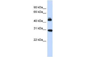 Host:  Rabbit  Target Name:  CBX4  Sample Type:  Fetal Brain lysates  Antibody Dilution:  1. (CBX4 Antikörper  (Middle Region))