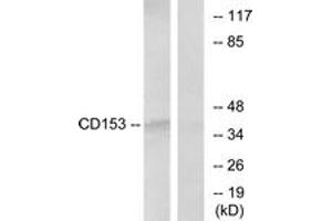 Western blot analysis of extracts from RAW264. (TNFSF8 Antikörper  (AA 71-120))